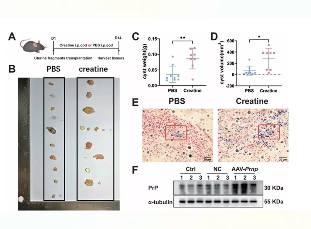 kreatin endometrióza